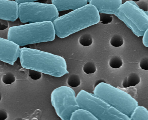 bacteria retained by track-etched membrane filters